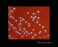 neisseria gonorrhoeae